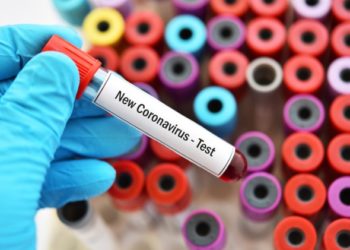 Les chiens et les chats peuvent-ils contracter le nouveau coronavirus (COVID-19)?