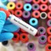 Les chiens et les chats peuvent-ils contracter le nouveau coronavirus (COVID-19)?