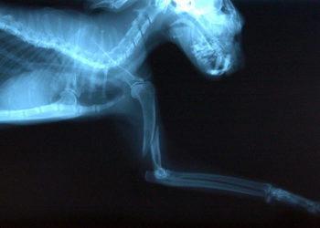 Arthrite: comment reconnaître et gérer la maladie