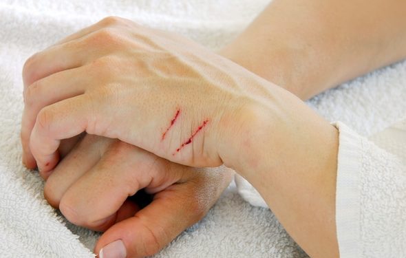 Comment traiter les égratignures des chats à la maison