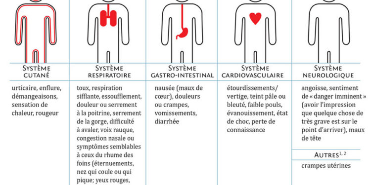 Quels sont les signes d'un choc anaphylactique ?