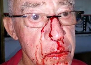 Comment savoir si mon chat a le nez cassé ?