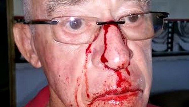 Comment savoir si mon chat a le nez cassé ?