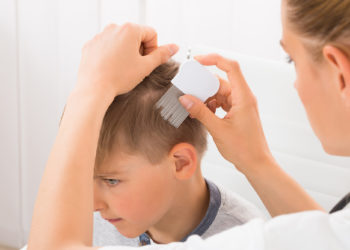 Comment se débarrasser définitivement des poux ?