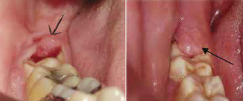 Comment s'appelle le liquide qui sort d'une plaie ?