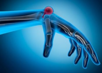 Comment savoir si c'est un kyste ou un ganglion ?