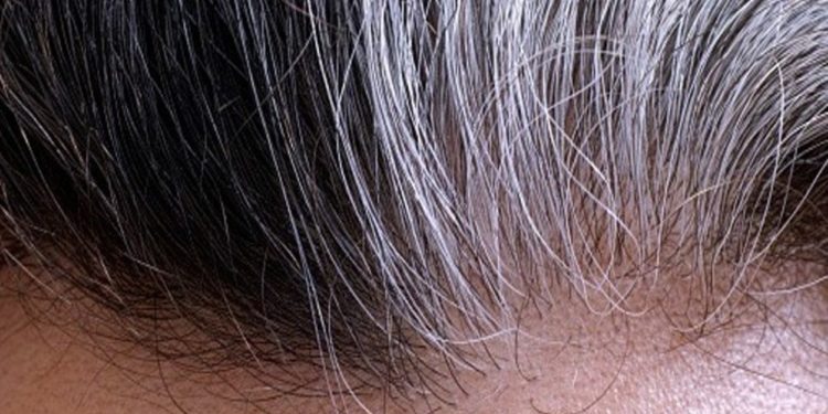 Comment faire pour ne plus avoir de pellicule ?