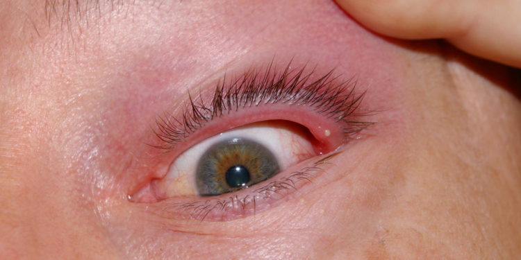 Comment faire partir un bouton sur l'œil ?