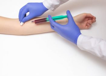 Comment soigner une urée élevée ?