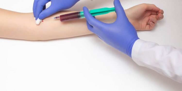 Comment soigner une urée élevée ?