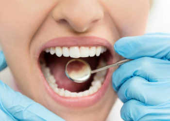 Comment faire partir un abcès naturellement ?