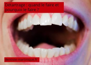 Quand faire détartrage chat ?