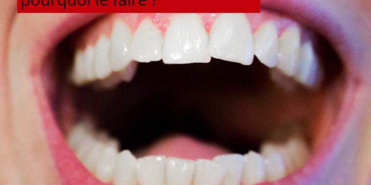 Quand faire détartrage chat ?