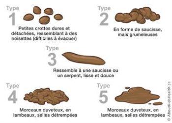 Comment faire sortir les selles dures ?