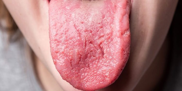 Quel aspect doit avoir la langue ?