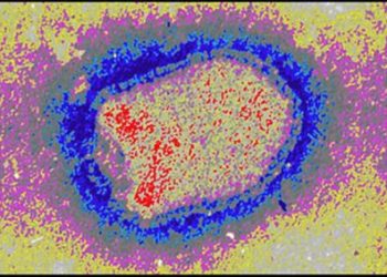 Quel est l'agent causal de la rage ?