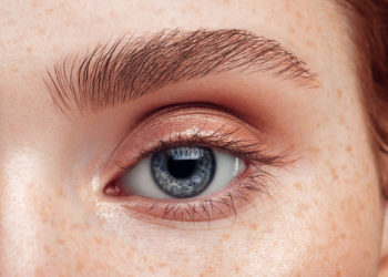 Comment se déclare une conjonctivite ?