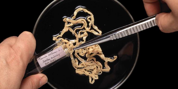 Comment savoir si l'on a un ver solitaire ?