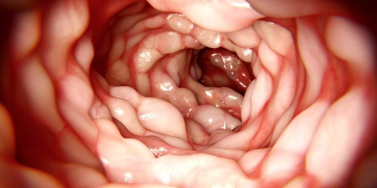 Qu'est-ce qui peut donner des selles noires ?