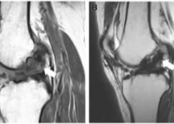 Quelles sont les caractéristiques de l'oiseau ?