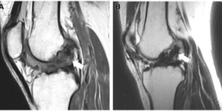 Quelles sont les caractéristiques de l'oiseau ?