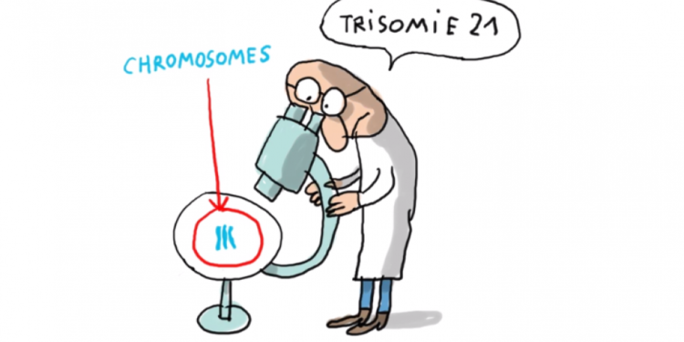 C'est quoi la trisomie ?