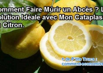 Comment faire mûrir un abcès dentaire rapidement ?