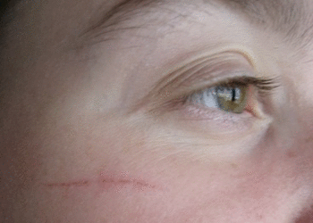 Comment soigner la peau d'un chat ?