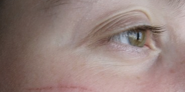 Comment soigner la peau d'un chat ?