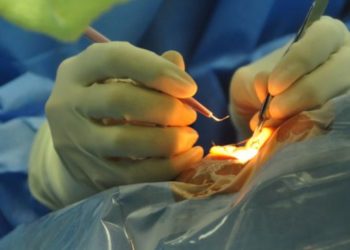 Comment savoir si c'est un kyste ou un cancer ?