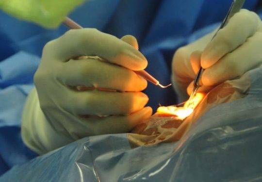 Comment savoir si c'est un kyste ou un cancer ?