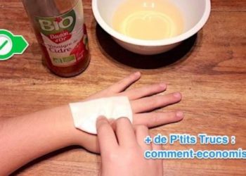 Comment désinfecter une plaie naturellement ?