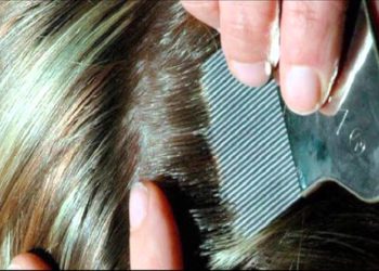 Pourquoi je trouve des lentes mais pas de poux ?