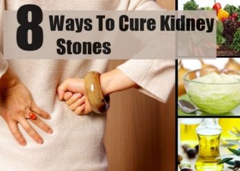 Comment Attrape-t-on des calculs rénaux ?