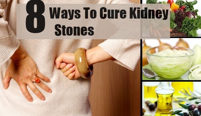 Comment Attrape-t-on des calculs rénaux ?