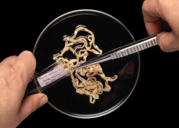 Comment savoir si l'on a un ver solitaire ?