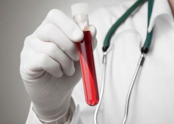 Quel bilan sanguin pour le pancréas ?