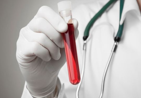 Quel bilan sanguin pour le pancréas ?