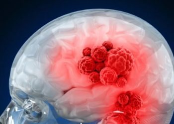 C'est quoi une tumeur bénigne ?