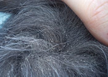 Comment savoir si les lentes sont mortes ?