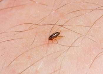 Est-ce que les puces restent sur l'homme ?