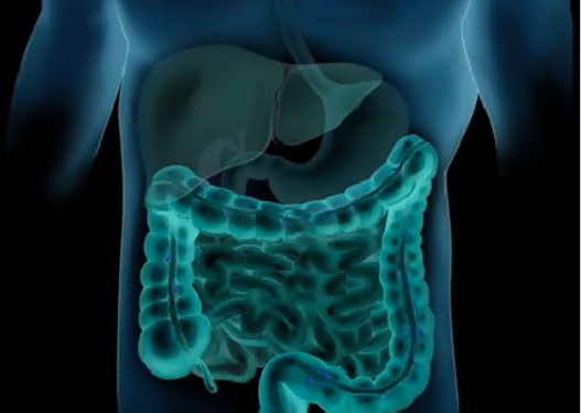 Comment faire un vermifuge naturel ?