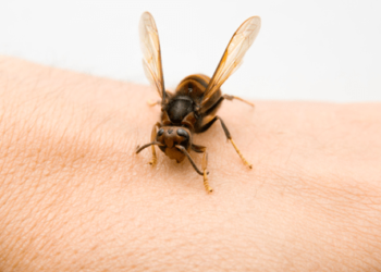 Pourquoi les insecte me pique ?