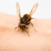 Pourquoi les insecte me pique ?