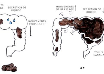 Comment faire passer un bouchon de selle ?