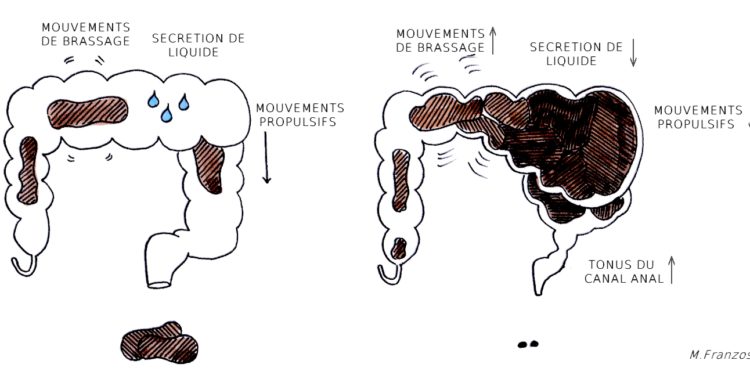 Comment faire passer un bouchon de selle ?