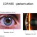 Comment cicatriser la cornée de l'œil ?