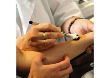 Est-ce que la gale du lapin est contagieuse pour l'homme ?