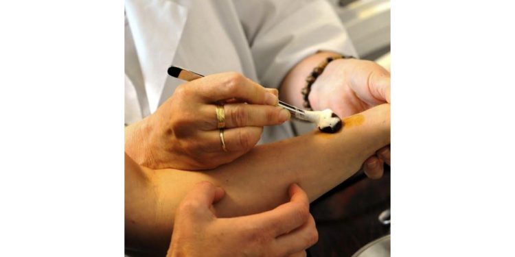 Est-ce que la gale du lapin est contagieuse pour l'homme ?