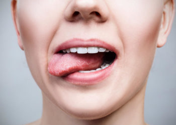 Quelle est la couleur normale de la langue ?